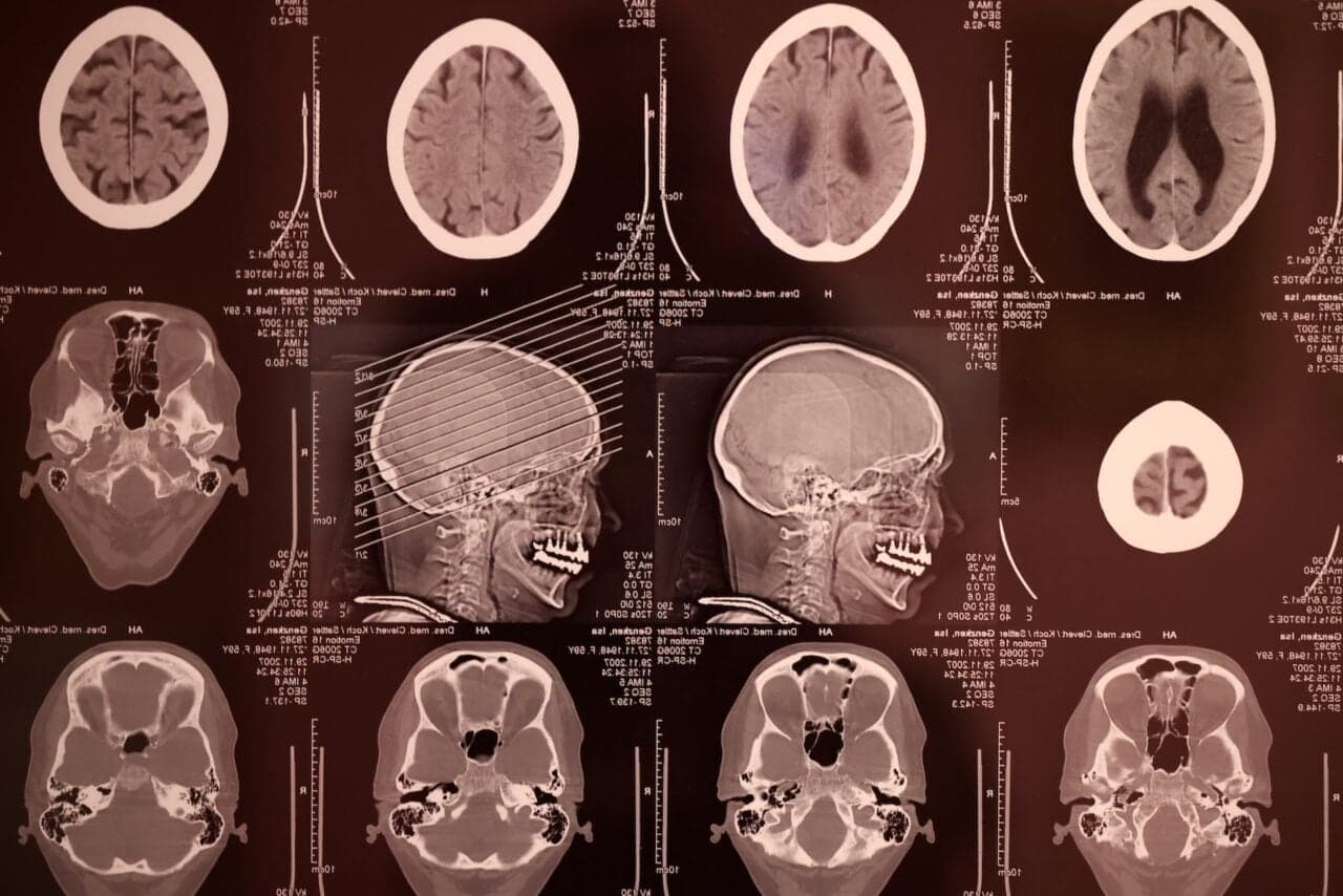 Meta’s AI Is Getting Better at Reading Your Thoughts—Without Cracking Open Your Skull