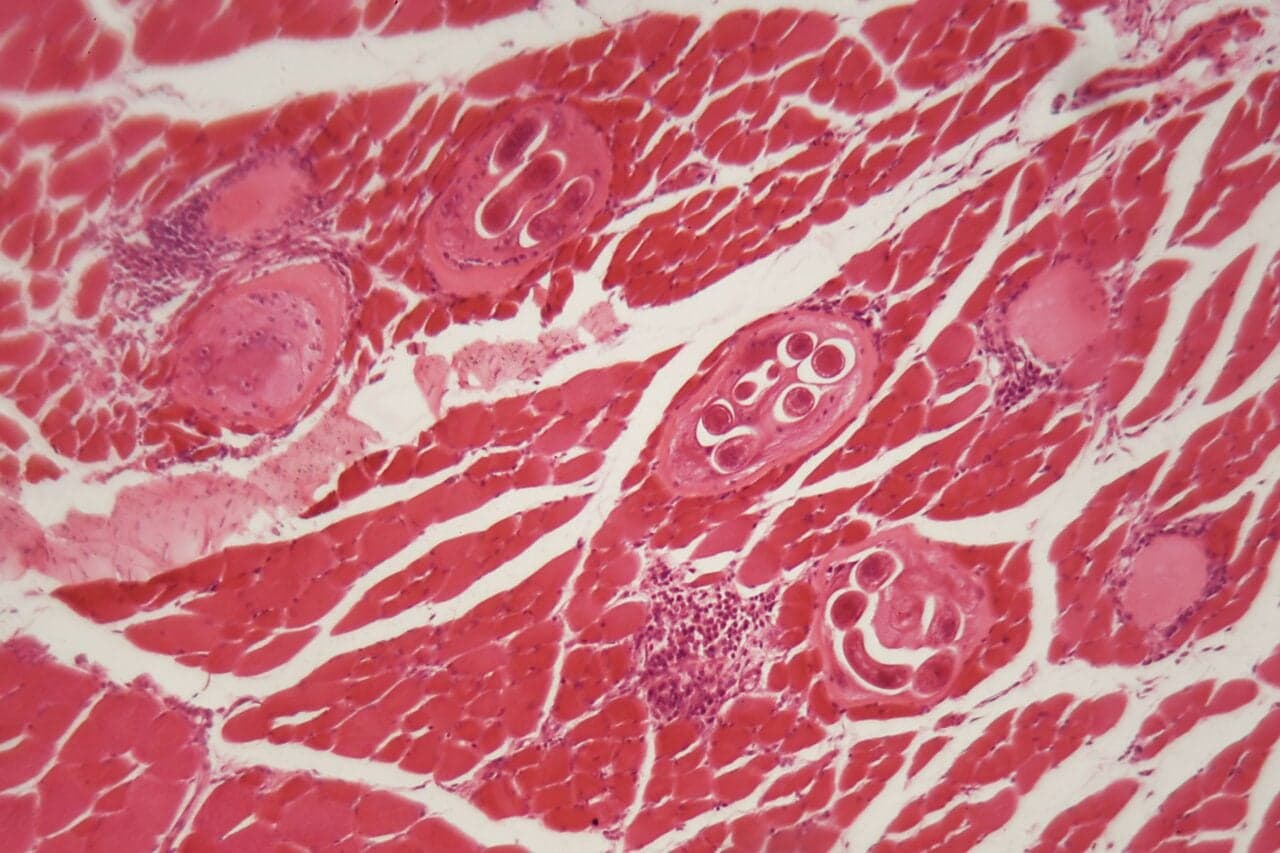 Contaminated Beef Jerky Triggers Bear Worm Infection Outbreak